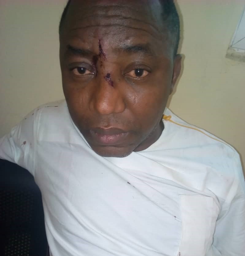 Injured Sowore in custody of the Nigeria Police