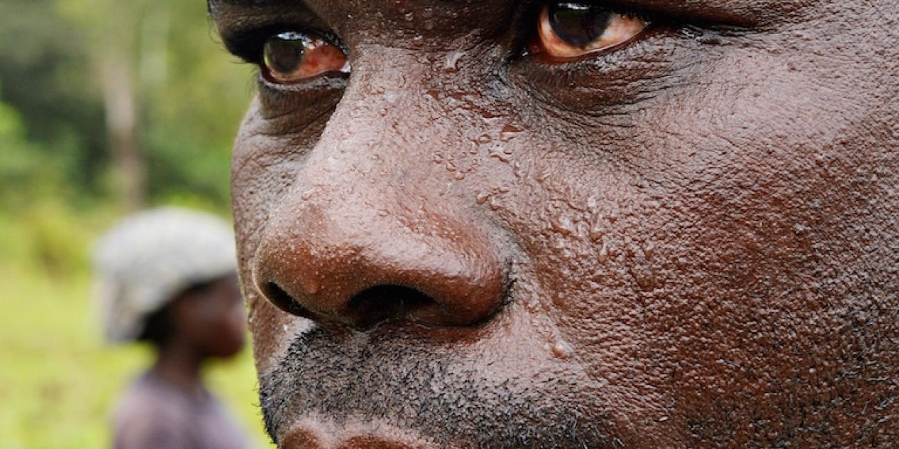 Farmer, Okechukwu Nduka from Okwuzi said people thought he was using drugs when his eyes started getting red some about 3 years ago, although he cannot tell if a major gas leakage around his farm at Mpata had anything to do with it