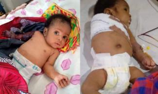 Nigerian Police Say No Complaint Yet On Two-Month-Old Baby Whose Hand Was Broken By Father For ‘Disturbing His Sleep’