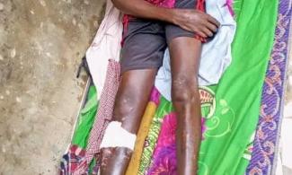 How Terrorist Attack In Buhari's Home State Turned Nigerian Man Into Beggar Living With Disability