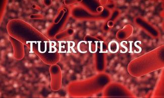 Can the Private Sector accelerate the ending of Tuberculosis in Nigeria?
