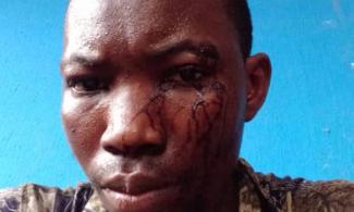 Silverbird TV Reporter Attacked, Brutalised By Nigerian Police For Filming Riot Incident In Oyo