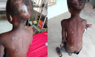 Nigerian Housewife Brutalises 7-Year-Old Domestic Help She Feeds Once Daily, For Failing To Clean Utensils In Adamawa