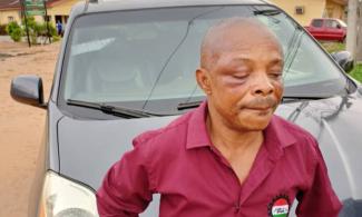 Nigeria Labour Congress President, Ajaero Brutalised, His Right Eye Completely Shut After ‘Thorough’ Beating