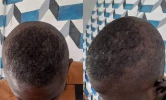 Borno CJTF Brutalises Nigerian Youth With Gun Barrel, Machete, Sticks For Wearing Afro Hairstyle, Forcibly Cuts His Hair And Detains Victim For Refusing To Pay For 'Service' 
