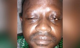 Traditionalist Leader ‘Loses’ Eye In Alleged Assault By Thugs Working For Lagos King As Monarch Denies Involvement