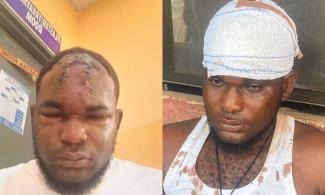 Lawless Nigerian Policemen Beat Delta Resident To Death, Extort N150,000 From Him Before His Demise 