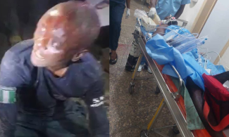 Nigerian Police Accused Of Releasing Drunk Inspector 24 Hours After Shooting Innocent Civilian In Ogun, Leaving Him Bedridden