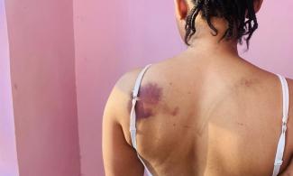 Lawless Nigerian Policemen In Delta Command Brutalise, Detain Woman For Days Over Alleged Possession Of Condom 