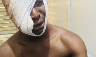 Gateway ICT Polytechnic Students Brutally Attacked In Ogun Communities; Stakeholders Call On Governor Abiodun, Police To Act